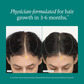 Nutrafol Women Advanced Hair Growth Supplement for Thinning Hair & Hair Loss – 120 Capsules