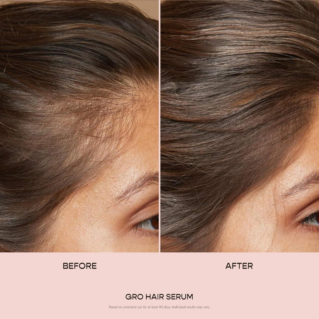VEGAMOUR GRO Hair Serum for Thinning Hair – Clinically Proven Formula for Thicker, Fuller-Looking Hair in 90 Days, Non-Oily, Vegan & Cruelty-Free, Bergamot Scent (1 oz)